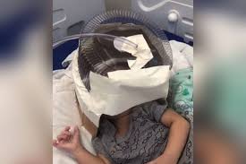 Hospital doRN usa embalagem de bolo como máscara de oxigênio para bebê